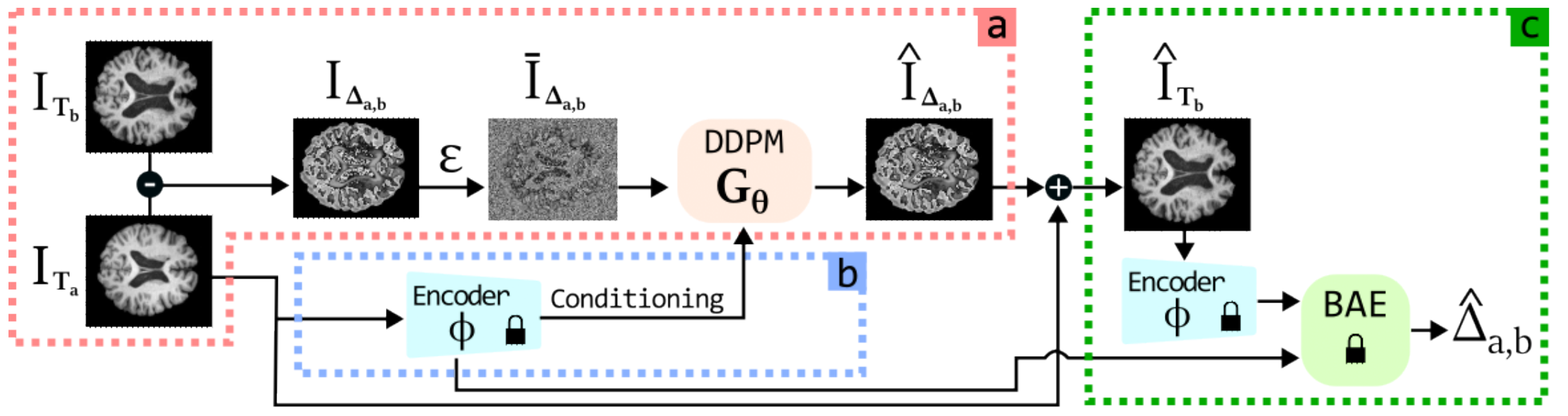 TADM: Temporally-Aware Diffusion Model for Neurodegenerative Progression on Brain MRI